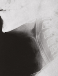 SBT_X-Ray