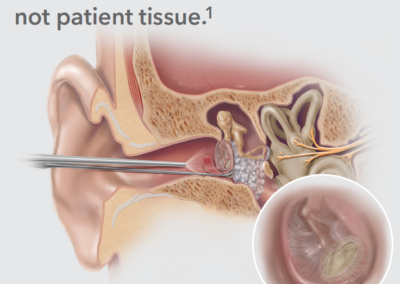 COOK Biodesign® Otologic Repair Graft