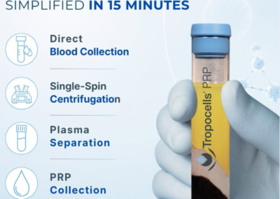 Tropocells® PRP